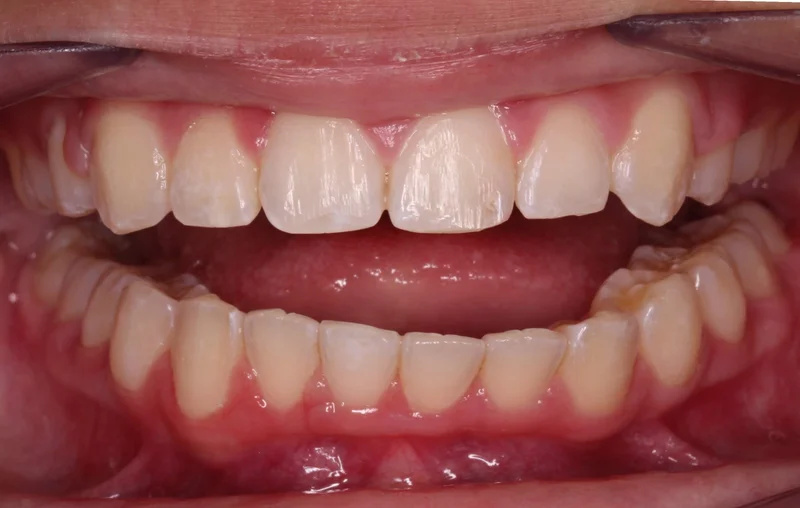 Center Open - Before Treatment