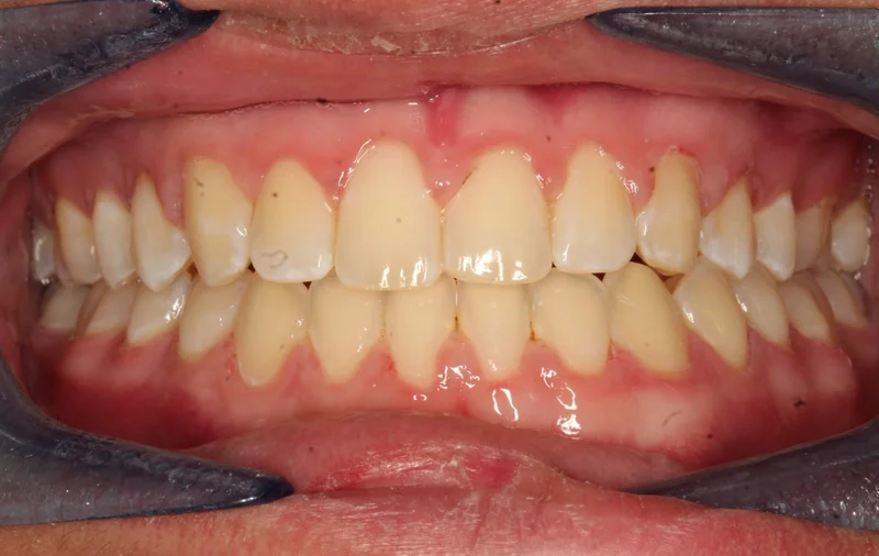 Center - After Treatment