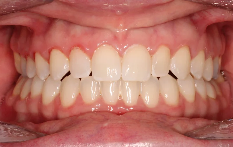 Center - After Treatment