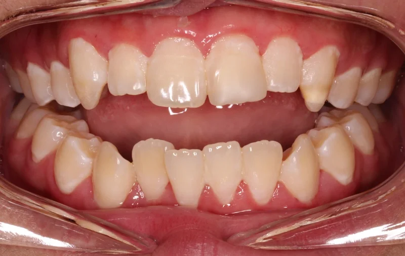 Center - Before Treatment