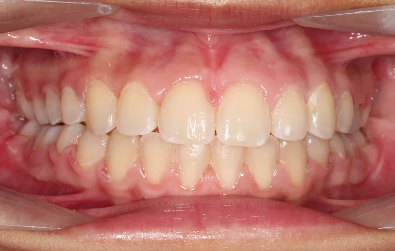 Center - After Treatment