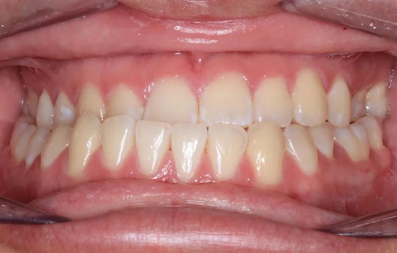 Center - Before Treatment