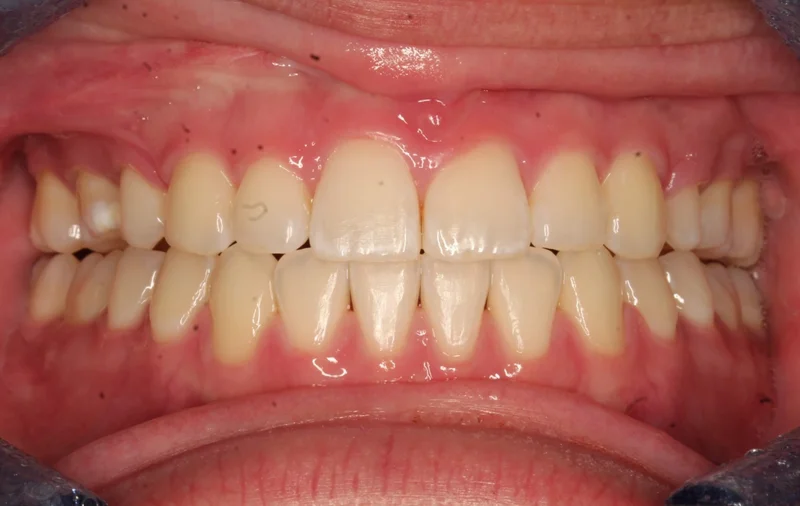 Center - After Treatment