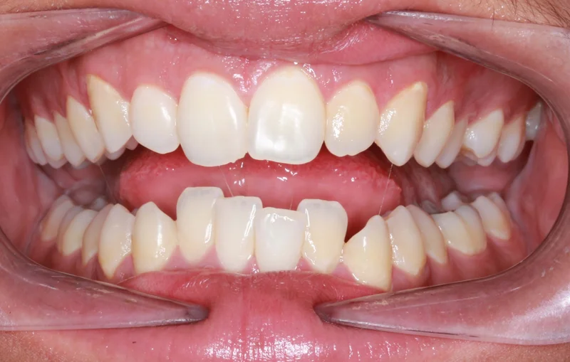 Center Open Smile - Before Treatment