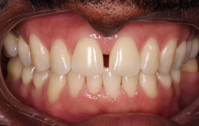 Center Closed - Before Treatment