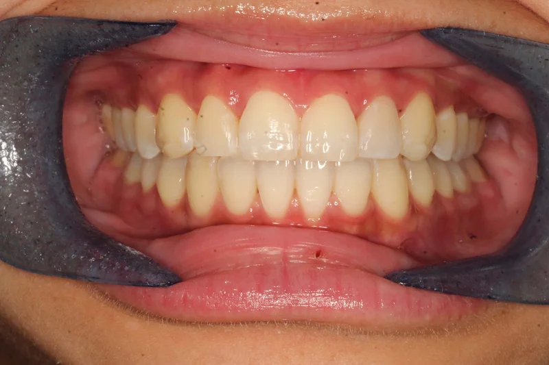 Center - After Treatment