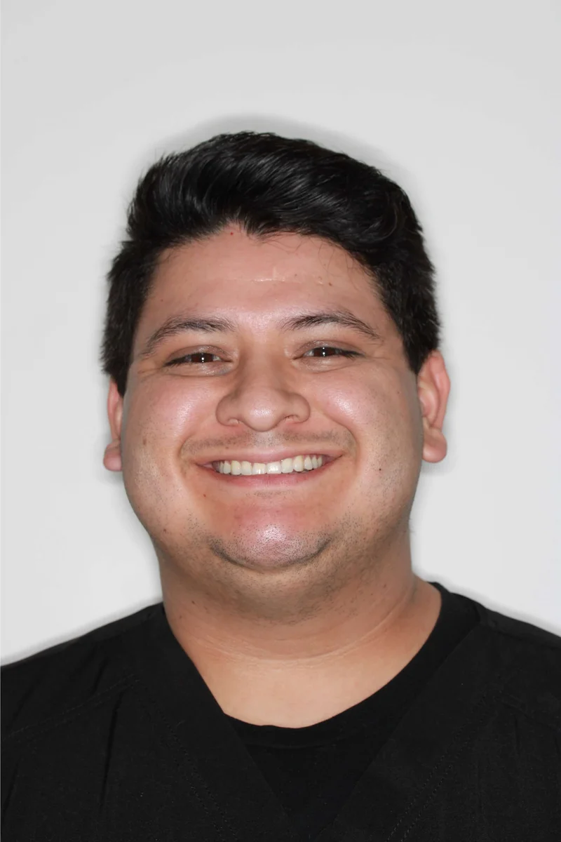 Front Facial Smiling - After Treatment