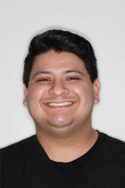 After Metal Braces treatment - Case 92667