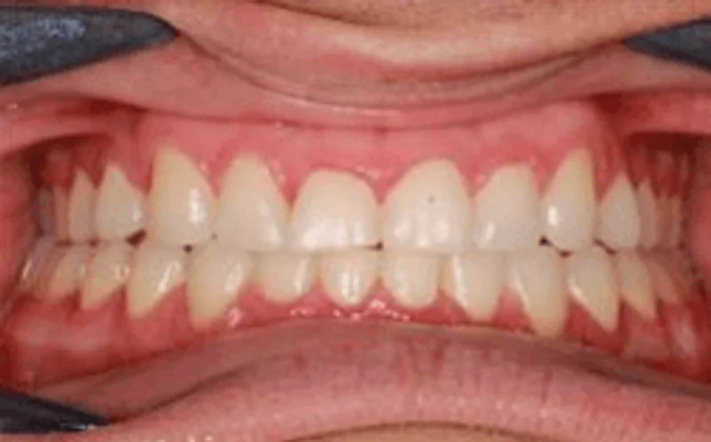 Center - After Treatment