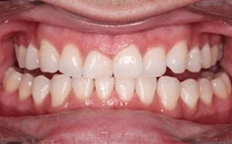 Center - Before Treatment