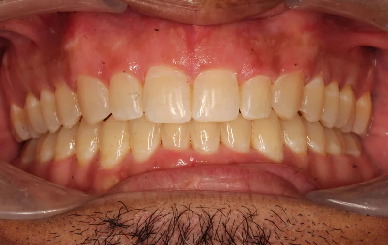 Center - After Treatment