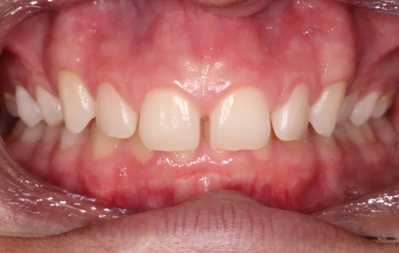 Center - Before Treatment