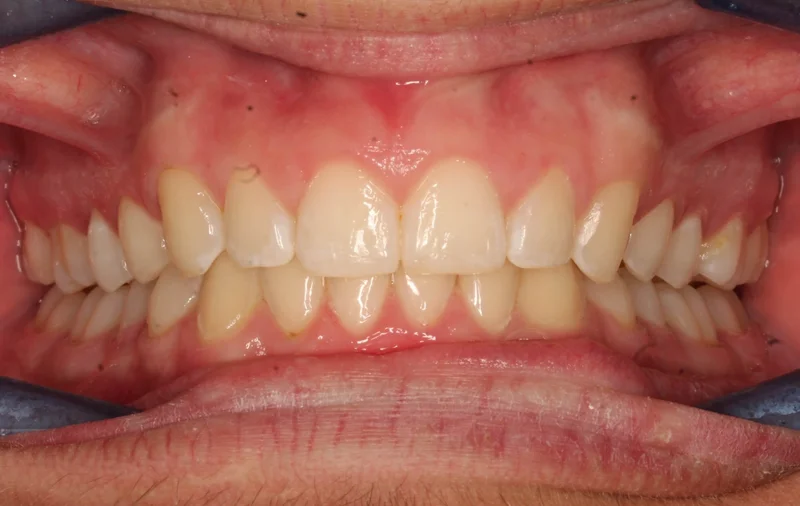 Center - After Treatment