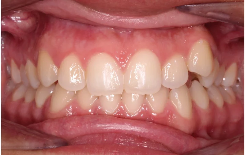 Center - Before Treatment