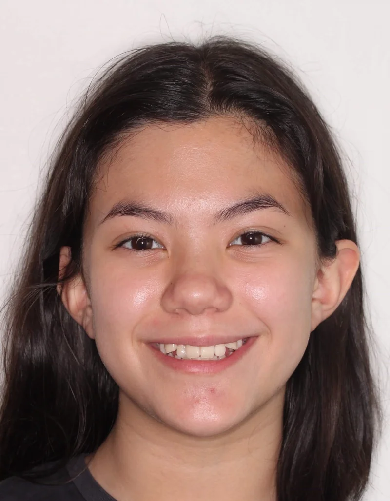 Center - Before Treatment