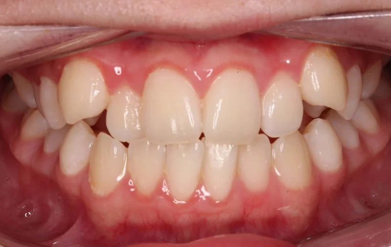 Center - Before Treatment