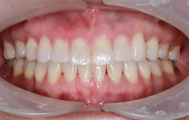 Center - After Treatment