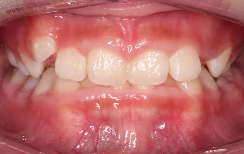 Center - Before Treatment