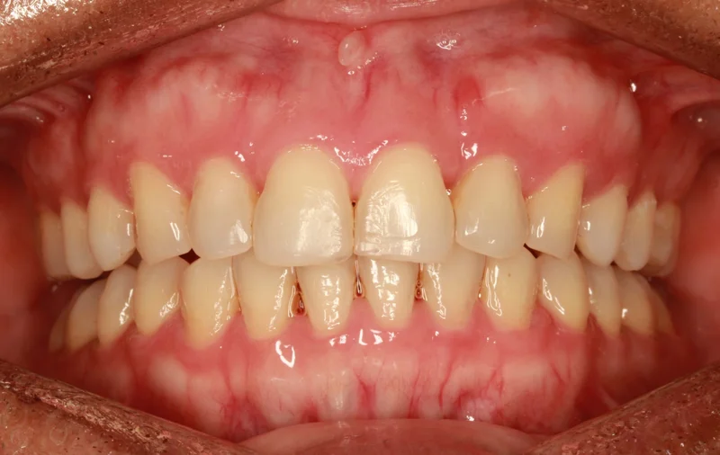 Center - After Treatment