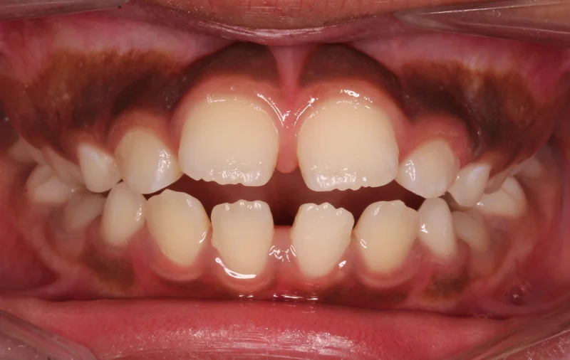 Center - Before Treatment