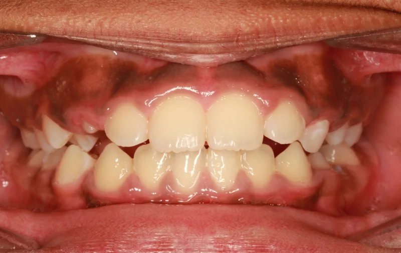 Center - After Treatment