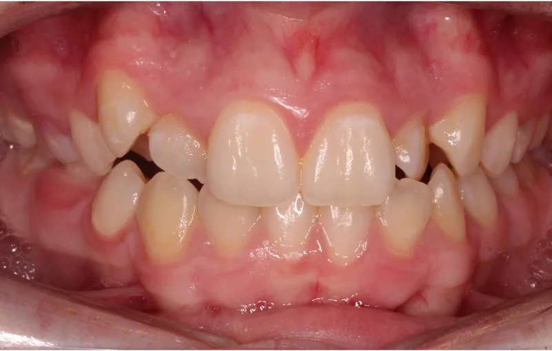 Center - Before Treatment