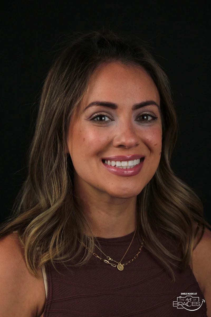 Smiling - After Treatment