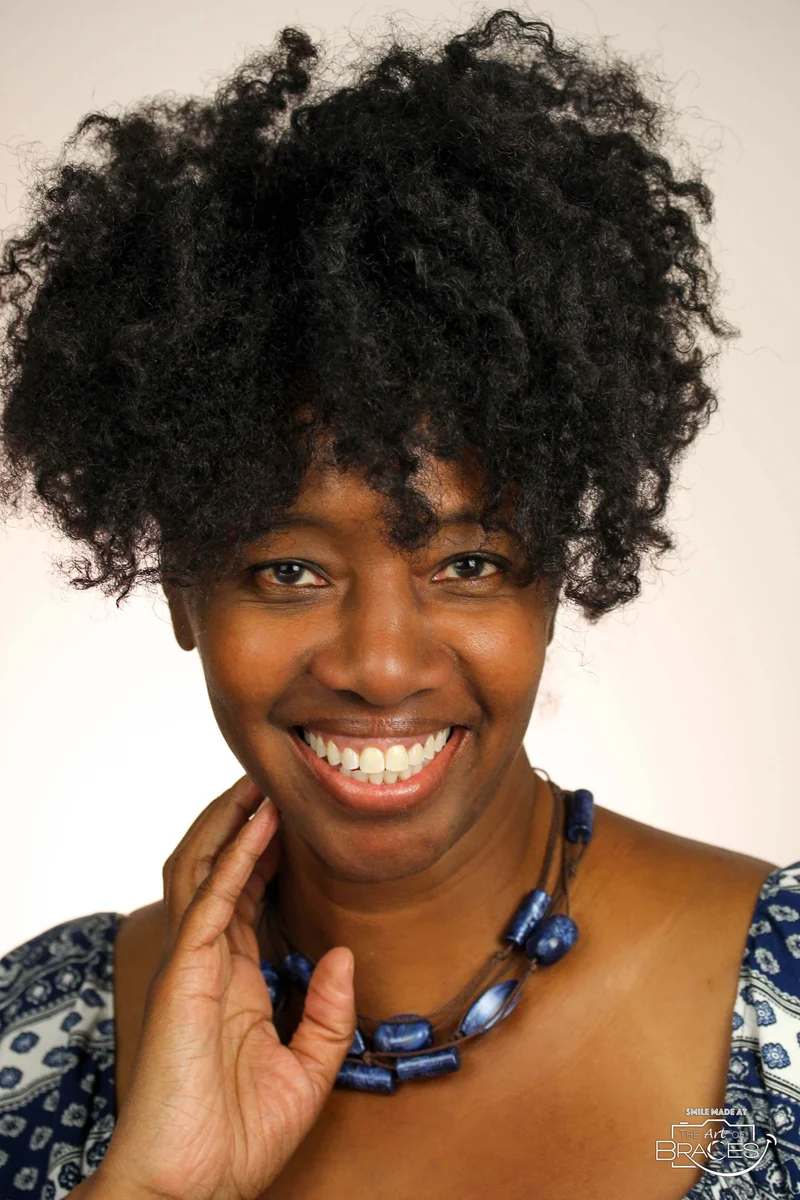 Smiling - After Treatment