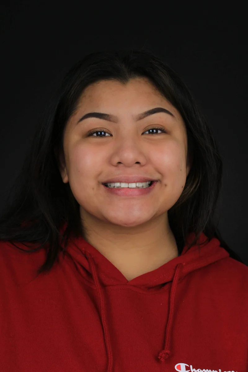 Facial Smiling - After Treatment