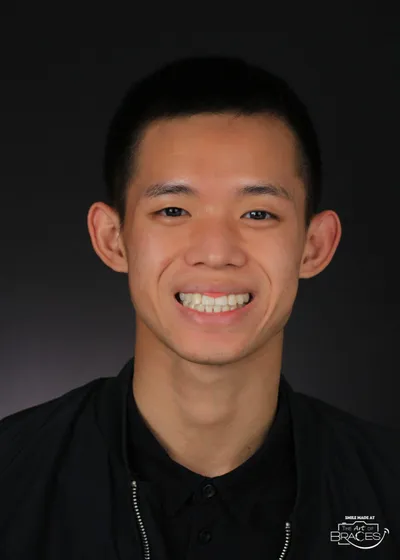 After Clear Braces treatment - Case 51196