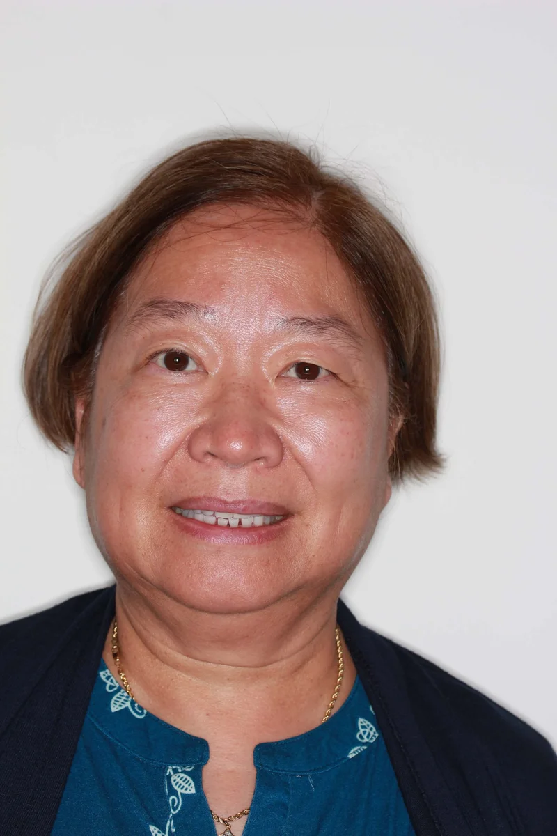 Facial Smiling - Before Treatment