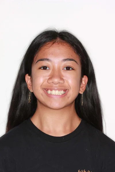 Before Clear Braces treatment - Case 53871