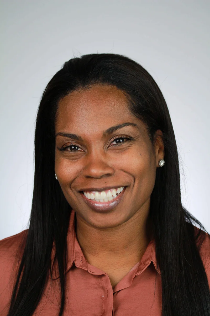 Facial Smiling - After Treatment