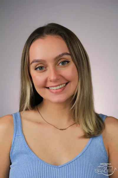 After Clear Braces treatment - Case 72586