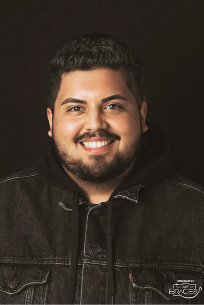 After Metal Braces treatment - Case 74377