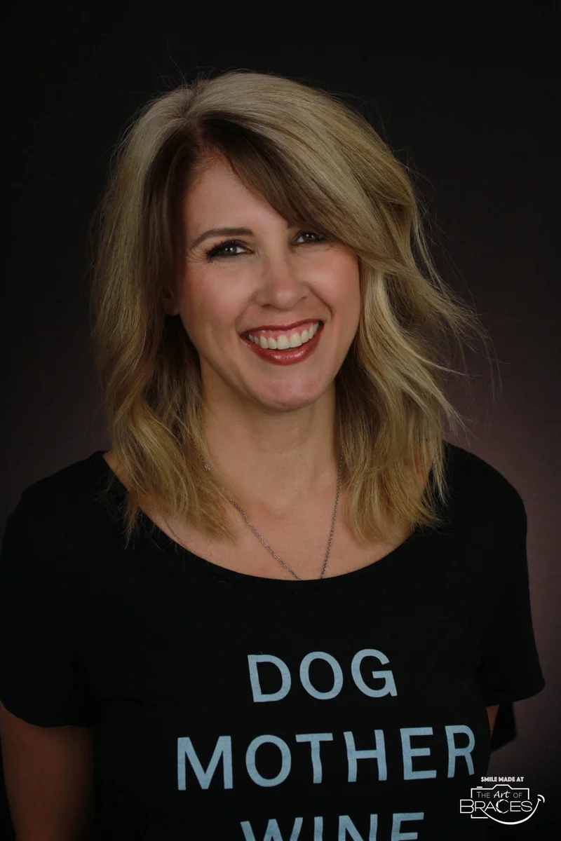 Facial Smiling - After Treatment