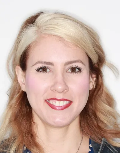 Before Clear Aligners treatment - Case 72703