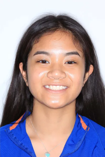 Before Clear Braces treatment - Case 84663