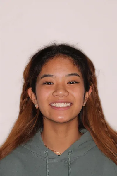 After Clear Braces treatment - Case 84663