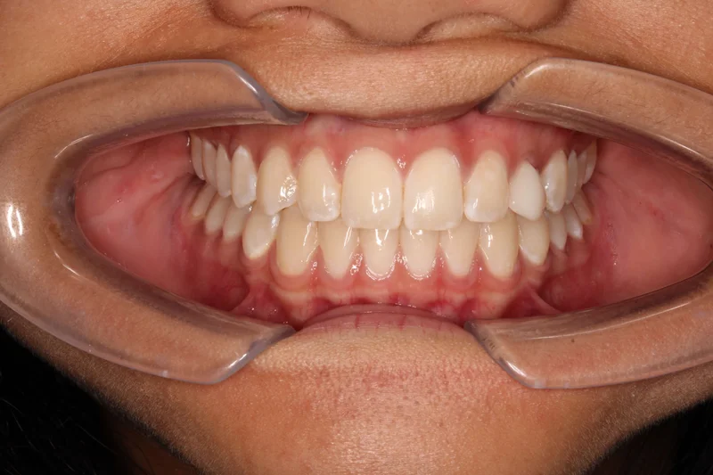 Center Closed - After Treatment