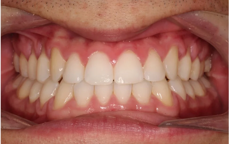 Center - After Treatment