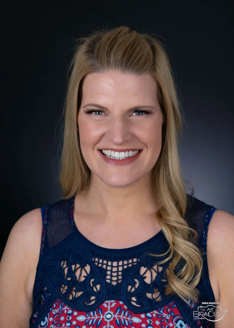 Facial Smiling - After Treatment