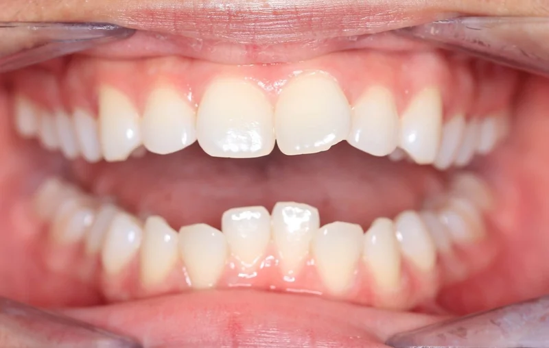 Center Open - Before Treatment