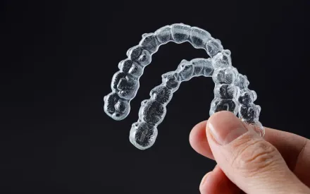 Clear Aligners preview